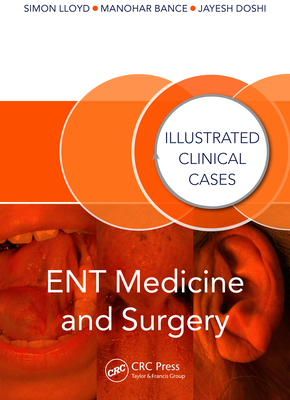 Full Download Ent Medicine and Surgery: Illustrated Clinical Cases - Simon Lloyd | ePub